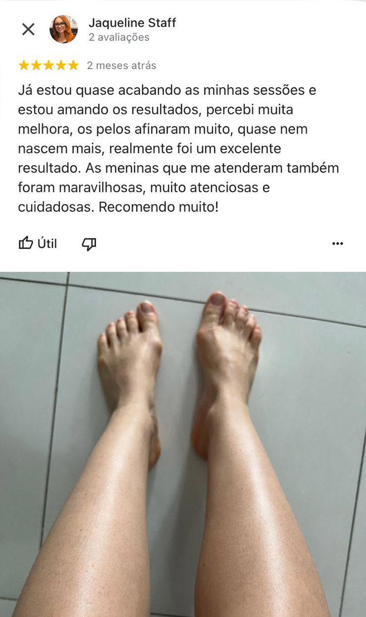 Google Reviews